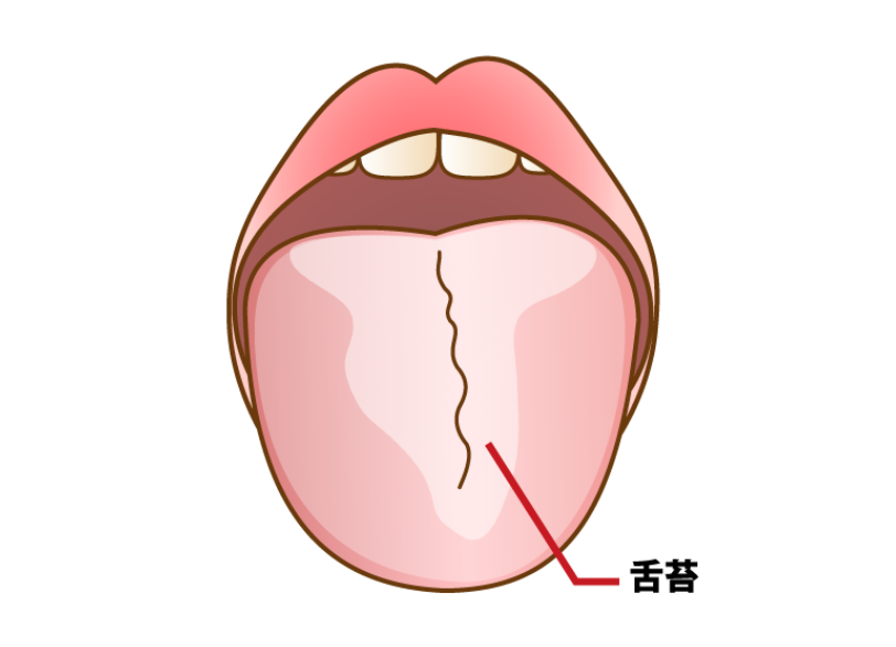 舌苔|RISEI